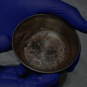 ¿Qué es la técnica FUE?