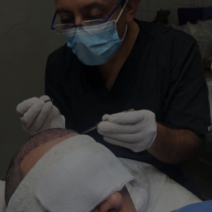 ¿Por qué se cae el pelo?