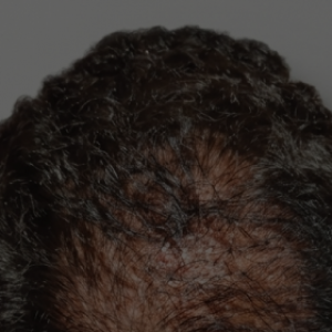 ¿Cuánto tiempo demora ver resultados??